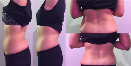 Cryo-T Shock EMS Slimming Session