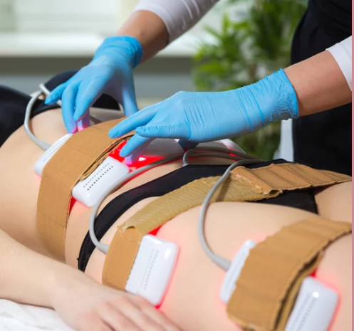 Body Contouring and Sculpting Lipo Laser - TWO Sessions